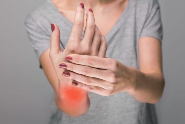 artritis reumatoide