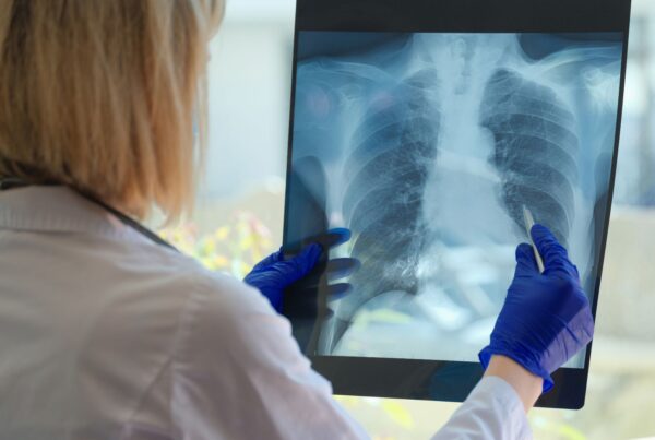 neumoconiosis